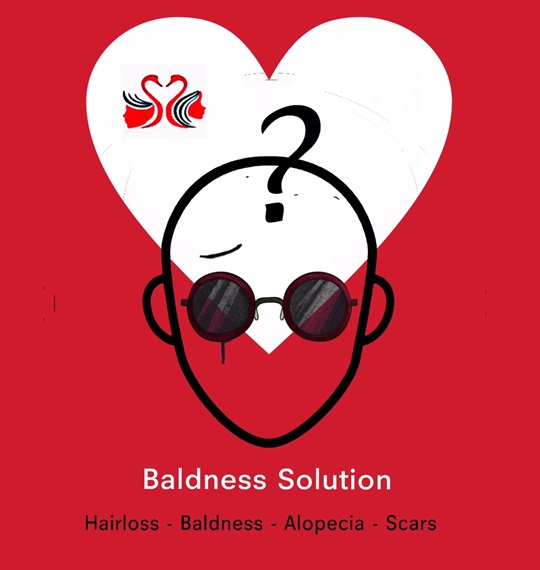 Baldness Solution.HC