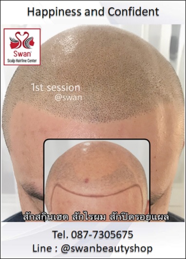 เรียนสักสกินเฮด.05